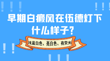 白癜风用伍德氏灯照是什么颜色