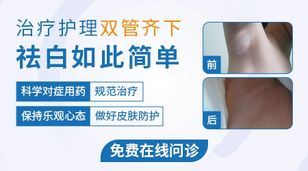 黑色素细胞移植手术大概得多少钱