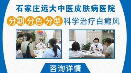 白癜风瓷白色和浅白色有什么区别