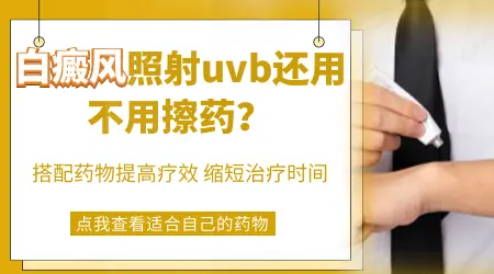 uvb治疗白斑地方要涂药吗