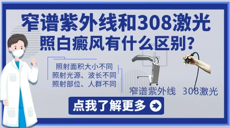 白癜风照308激光和窄普紫外线的区别