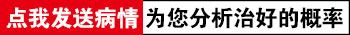 白癜风要多久照一次窄普灯