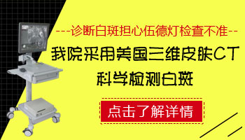 伍德灯照出淡蓝色荧光是不是白癜风