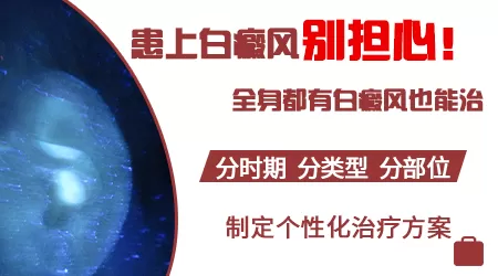白癜风多年全身变白会怎么样