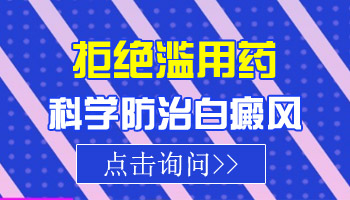 晕痣型白癜风通过抹药能好吗