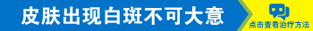 脸上一片一片的发白是长白癜风了吗