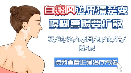 白斑周围皮肤变白怎么回事