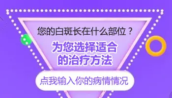 白癜风导致头发变白了还能恢复吗