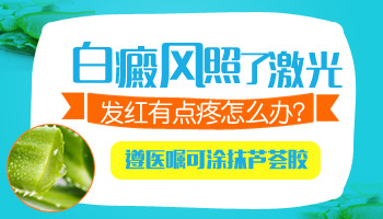 脸上白癜风照了308激光红痒可以抹芦荟胶吗