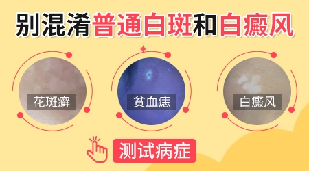 腿上有白色的斑点图片