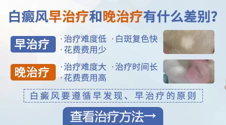 避免白癜风增多的方法有哪些