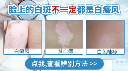 脸上豆大白色斑点光滑不脱皮是什么
