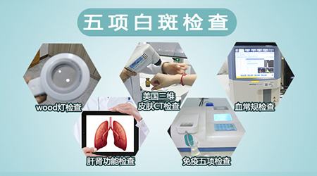 白癜风全面体检有没有必要 白斑要做哪些检查