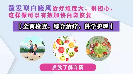 散发型白斑容易治好吗