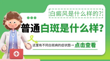 白癜风初期症状什么样