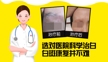 一岁宝宝大腿上有不明显的白斑是怎么回事