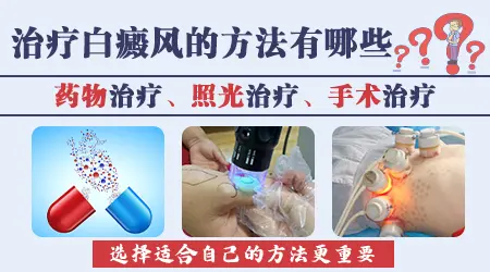 白癜风光照前涂抹什么药好