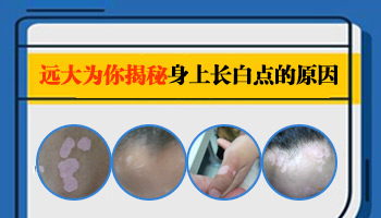 男宝宝大腿外侧白斑有变大是什么原因导致的