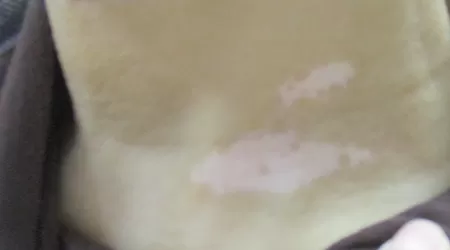 脖子上有白色的小点点