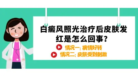 白癜风照光后发红是要好了吗