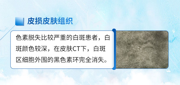 北京专家来啦！！特邀北京白癜风专家——苏有明教授将于4月5日来院会诊