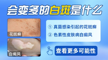 宝宝肚子上的白斑越来越多了