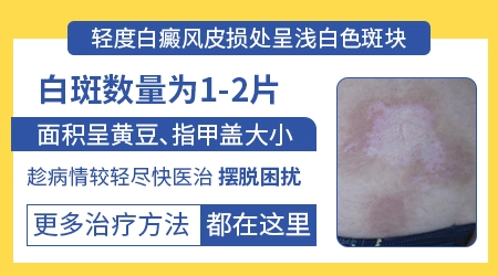 儿童白癜风初期症状