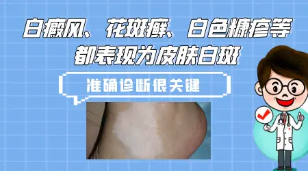 脖子上白一块是什么原因引起的