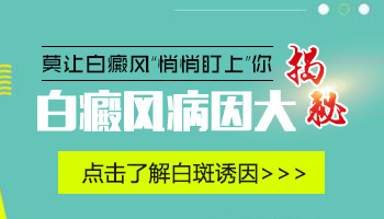 血热会导致白癜风吗 白癜风的发病原因有哪些