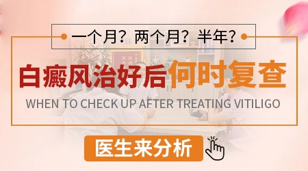 白斑多久复查一次伍德灯