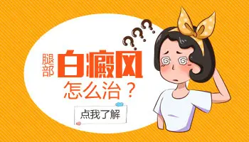 四肢白癜风怎么治