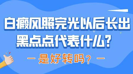 白癜风照光出现黑点还要继续照吗