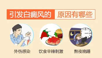 青少年长白斑原因 白斑影响上大学吗