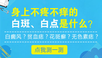 石家庄身上长白点是什么原因 石家庄治疗白癜风医院