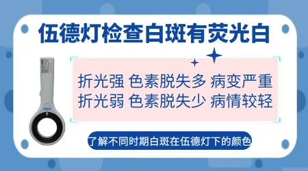 伍德灯下淡白色荧光边界不清是什么