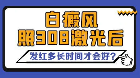 孩子白癜风照308激光后发红几天能下去