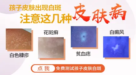 两个月宝宝脖子有白斑
