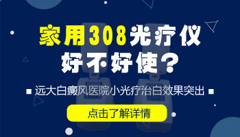 自己买的白癜风仪器可以用吗
