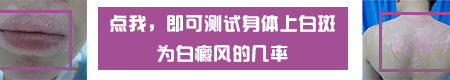 眼睛下方有光滑的白斑是什么