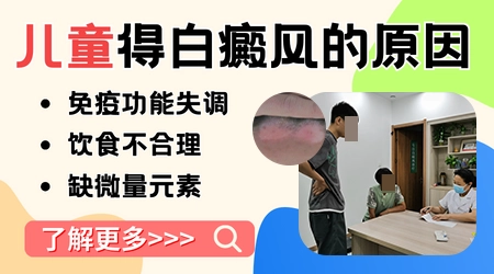 儿童得白癜风原因是什么