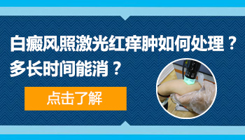 308激光治疗白癜风后皮肤红痒怎么办