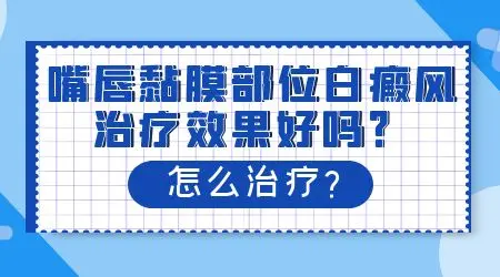 嘴唇白癜风可以表皮移植吗