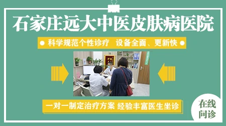 土方法治白癜风偏方 石家庄专注治疗白斑