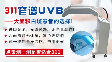 uvb治疗白癜风有没有效果