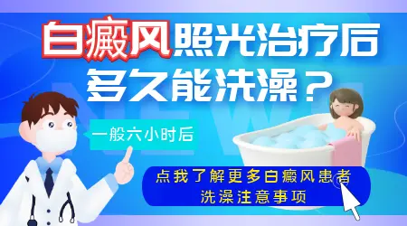 白癜风光疗后可以洗澡吗