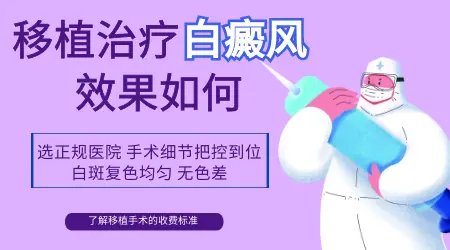 手背白点能做表皮移植手术吗