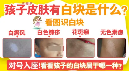 男孩身上白了一片是什么病