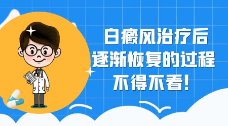 眼皮上有白癜风能照308激光治疗吗