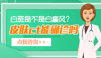 伍德灯照白斑照出来是白色的怎么回事