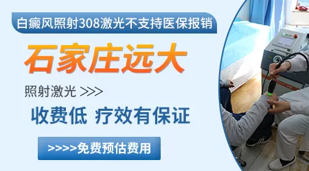 激光308照白癜风收费标准